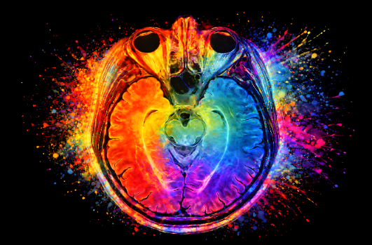 Multicolor Splash Axial Brain Anatomy Art