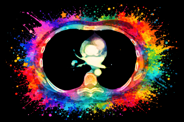 Multi-Color Splash PE Anatomy Art