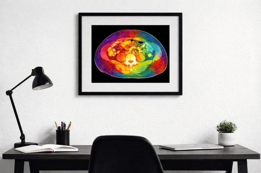 Multi-Color Abdomen Anatomy Wall Art - Black Background